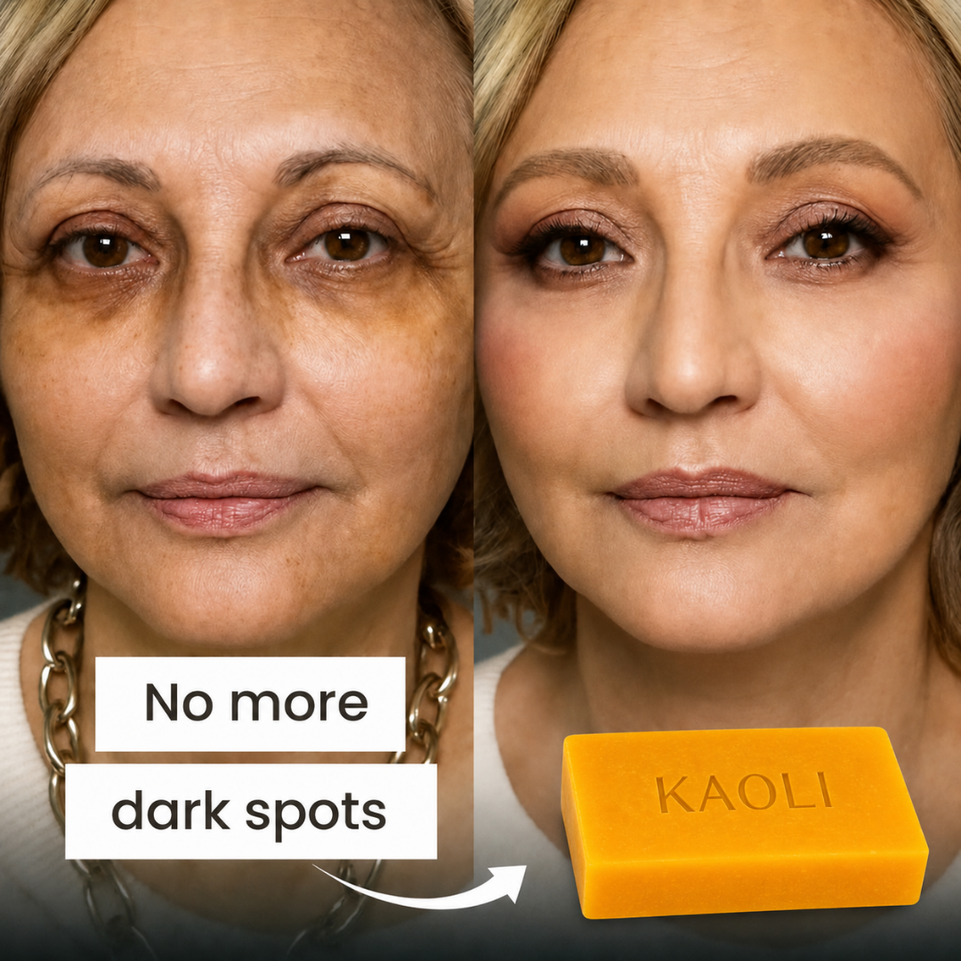 ✨ Limited-Time Offer ✨ Turmeric & Kojic Acid - Brightening Soap (Buy 1 Get 1 Free)