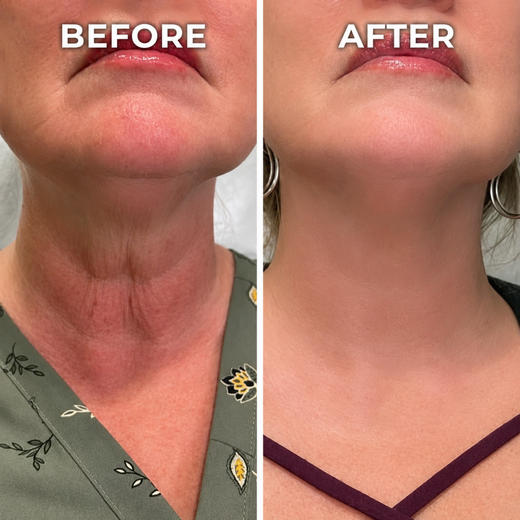🔥👩‍⚕️ Fubsta  SkinFirming Rejuvenating Serum ✨